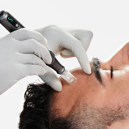 Microneedling - hva er det og hvorfor er behandlingen så populær?