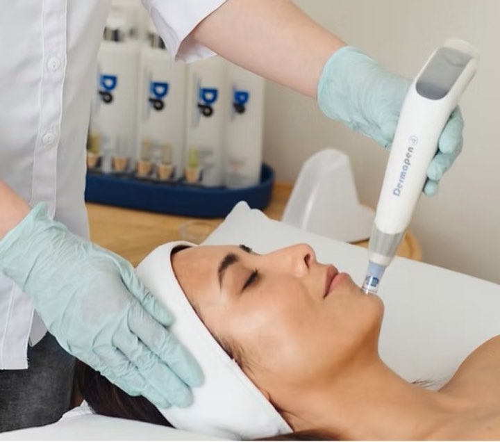 Dermapen - En effektiv hudforbedrende behandling